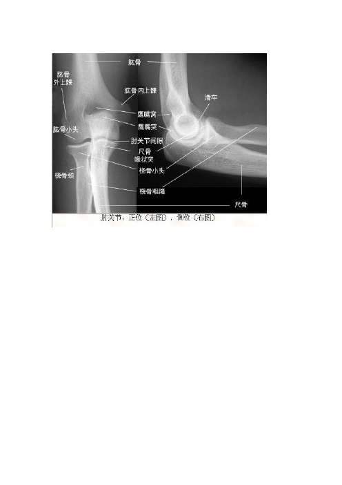 X线读片宝典(绝版)