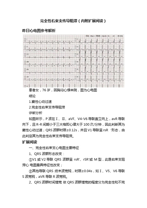 完全性右束支传导阻滞（内附扩展阅读）