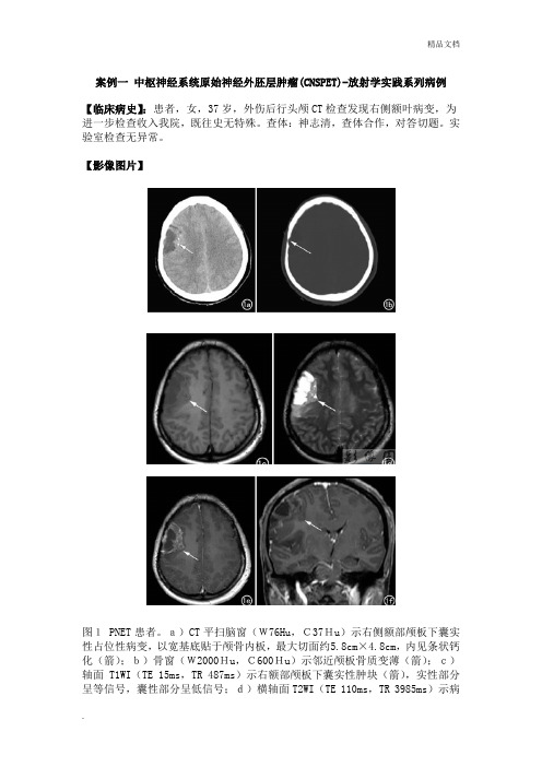 影像诊断学案例