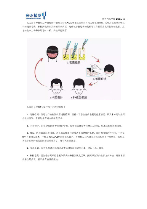 头发怎么种植头发种植费用一般是多少呢