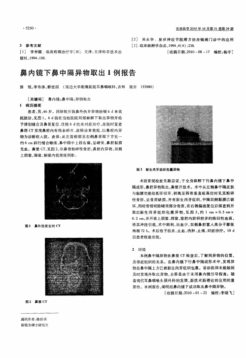 鼻内镜下鼻中隔异物取出1例报告