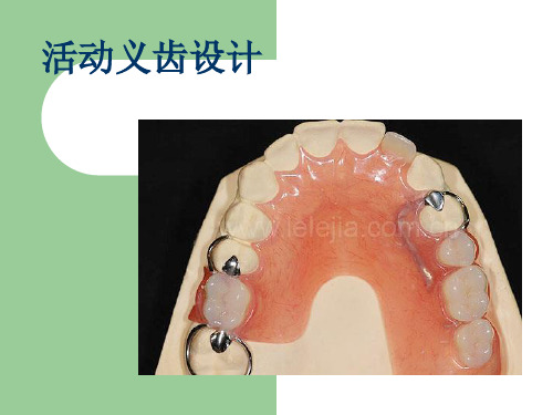 活动义齿设计