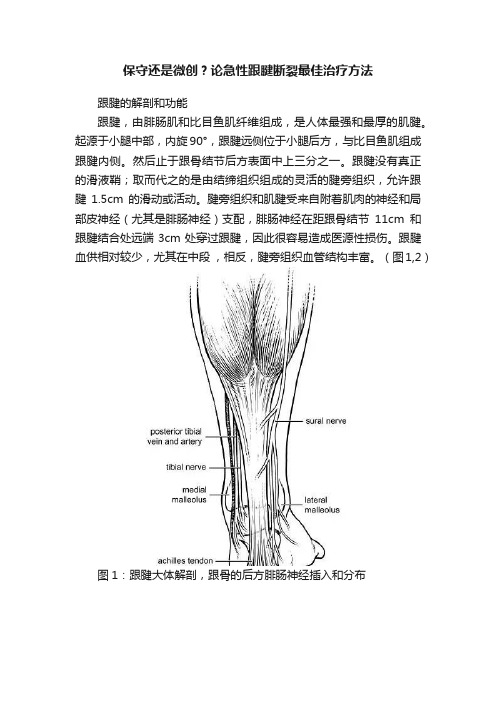 保守还是微创？论急性跟腱断裂最佳治疗方法