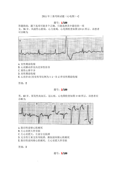 三基考核试题答案(心电图)