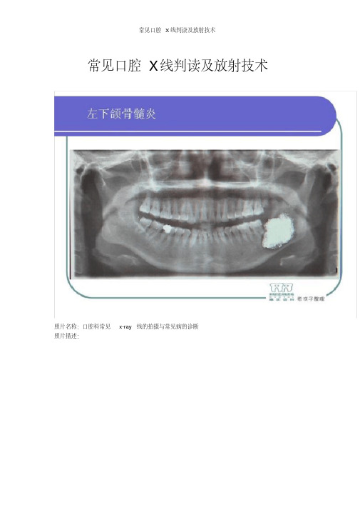 常见口腔x线判读及放射技术