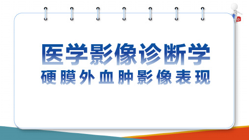 中枢神经系统影像诊断 常见病影像学表现 硬膜外血肿