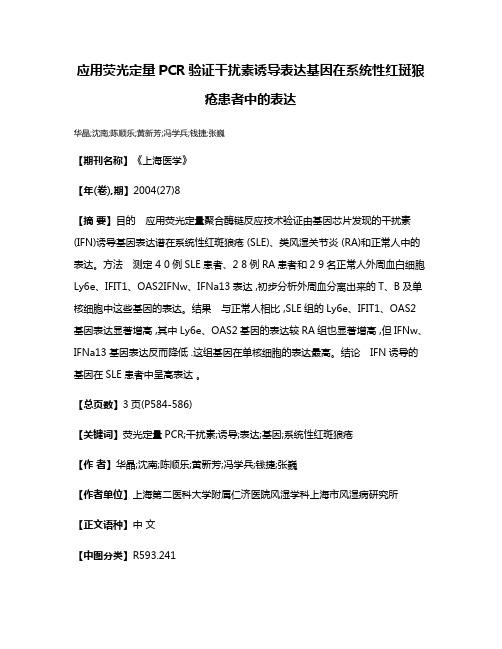 应用荧光定量PCR验证干扰素诱导表达基因在系统性红斑狼疮患者中的表达