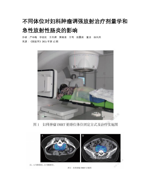 不同体位对妇科肿瘤调强放射治疗剂量学和急性放射性肠炎的影响