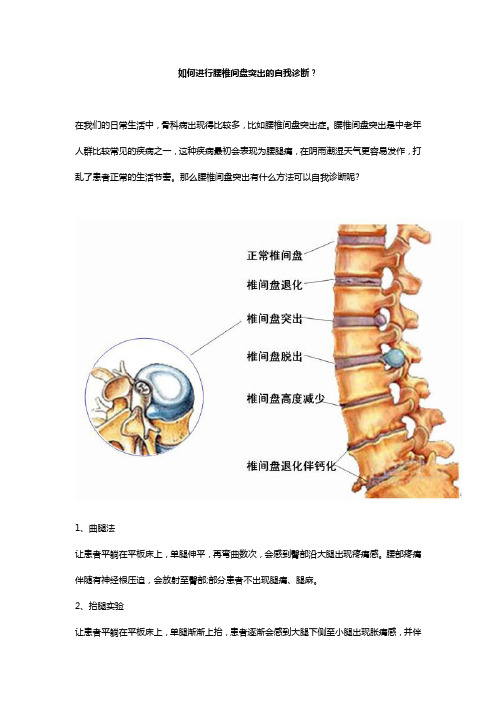 如何进行腰椎间盘突出的自我诊断？