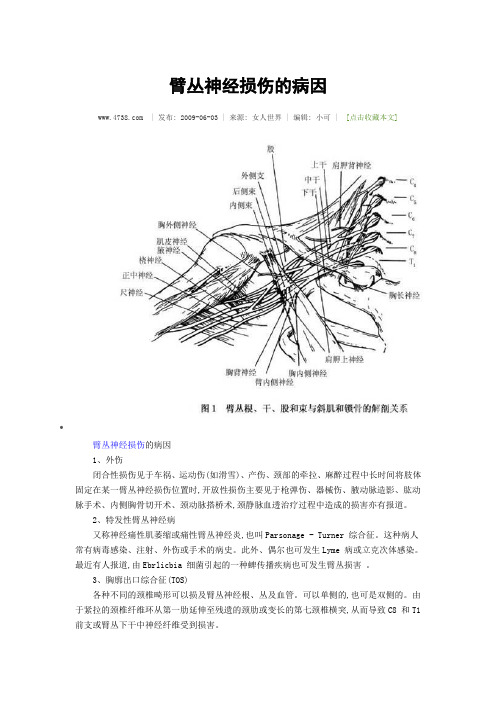 臂丛神经损伤的病因