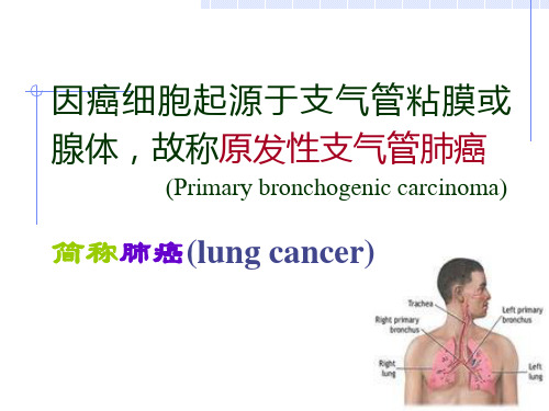 肺癌PPT课件
