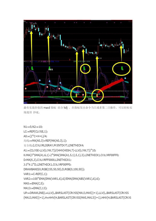 MACD逃顶抄底必备通达信指标公式源码