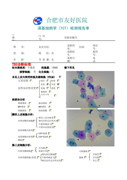 TCT报告单TBS格式