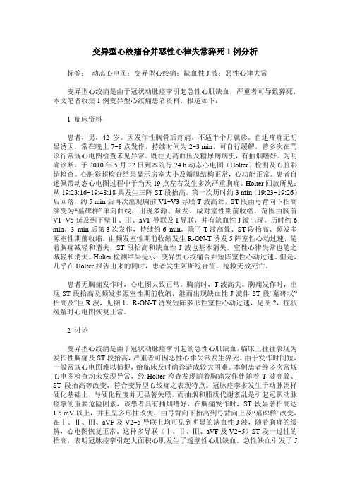 变异型心绞痛合并恶性心律失常猝死1例分析