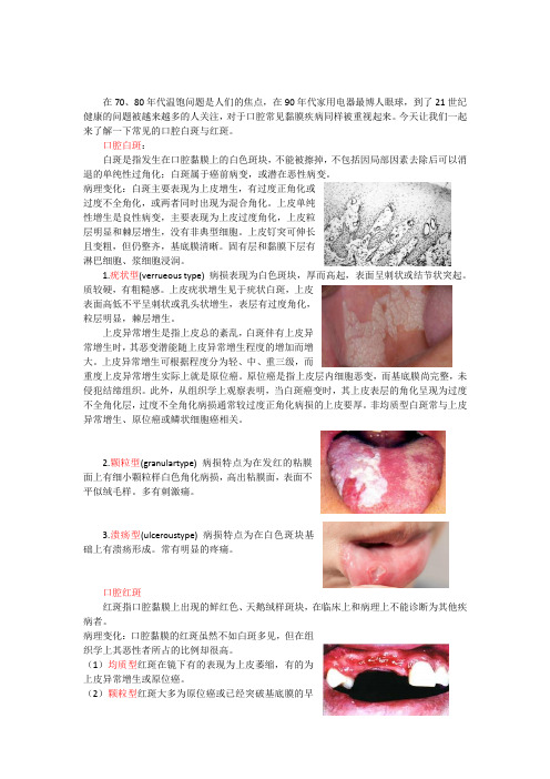 口内黏膜病-红斑白斑