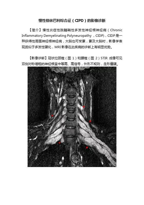 慢性格林巴利综合征（CIPD）的影像诊断