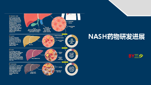 NASH药物研发进展