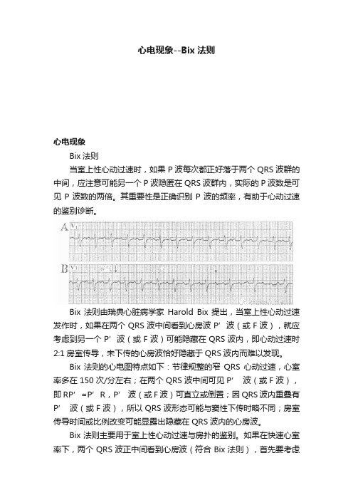 心电现象--Bix法则