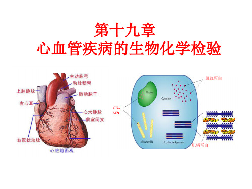 第十九章 心血管疾病的生物化学检验