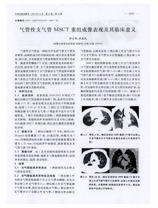 气管性支气管MSCT重组成像表现及其临床意义