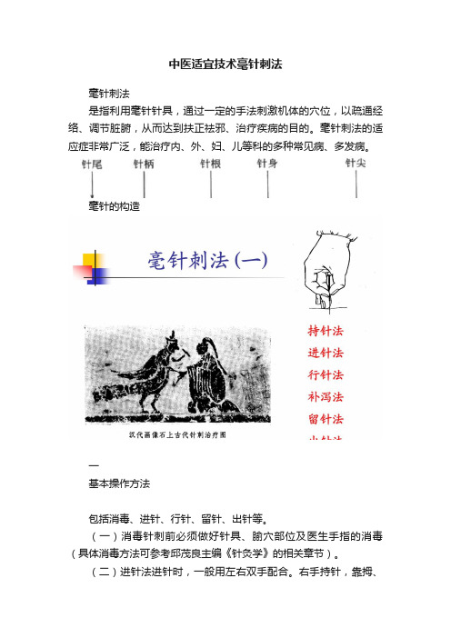 中医适宜技术毫针刺法