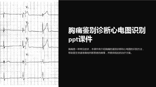 胸痛鉴别诊断心电图识别课件