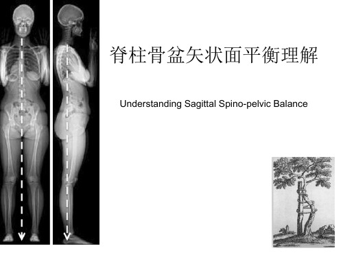 脊柱骨盆矢状面平衡理解