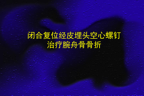 闭合复位微创经皮埋头空心螺钉治疗腕舟骨骨骨折课件