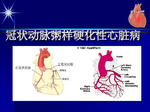 冠状动脉粥样硬化性心脏病