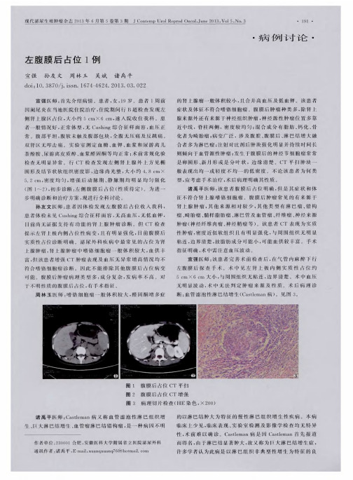 左腹膜后占位1例