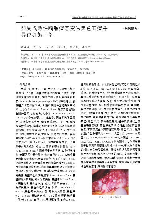 卵巢成熟性畸胎瘤恶变为黑色素瘤并异位妊娠一例