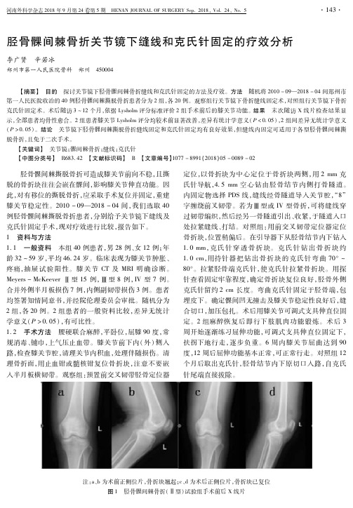 胫骨髁间棘骨折关节镜下缝线和克氏针固定的疗效分析