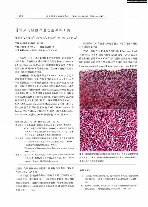 胃低分化腺癌和淋巴瘤并存1例