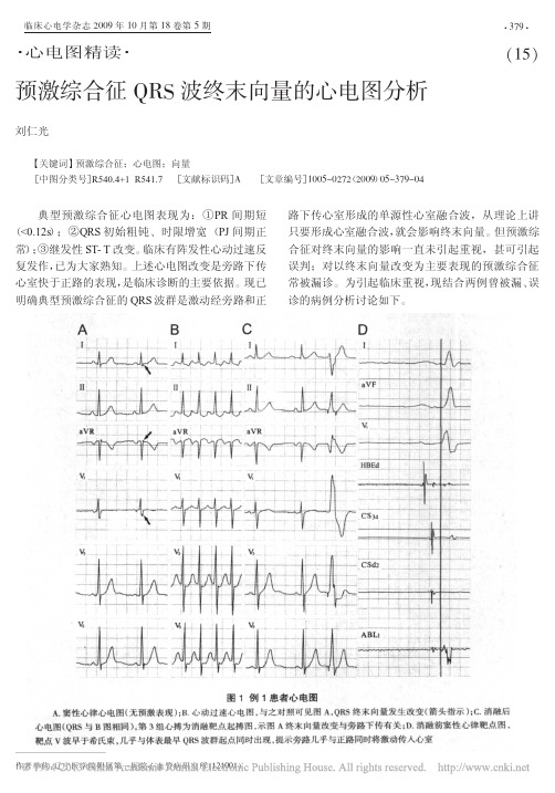 预激综合征QRS波终末向量的心电图分析