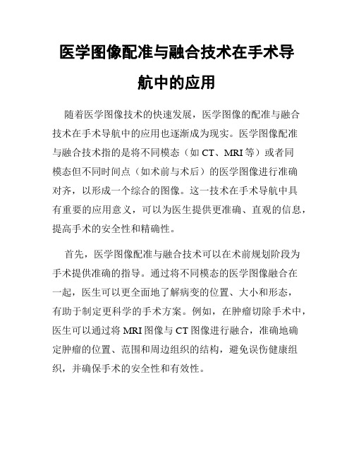 医学图像配准与融合技术在手术导航中的应用