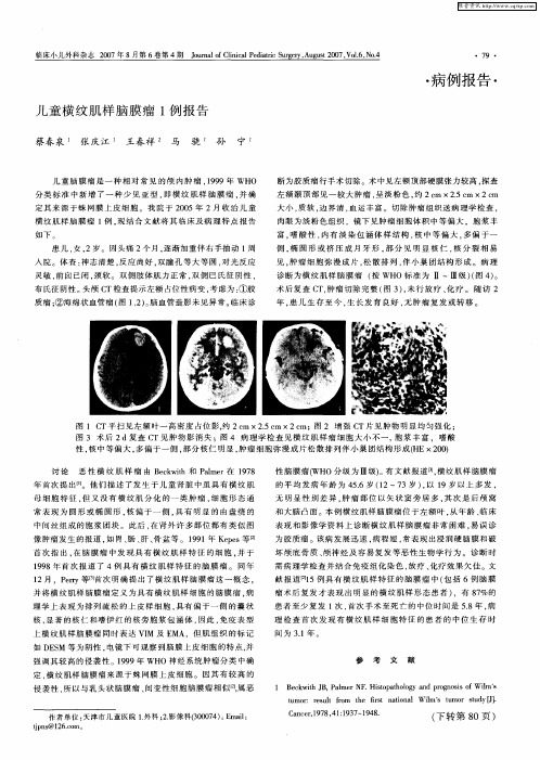 儿童横纹肌样脑膜瘤1例报告