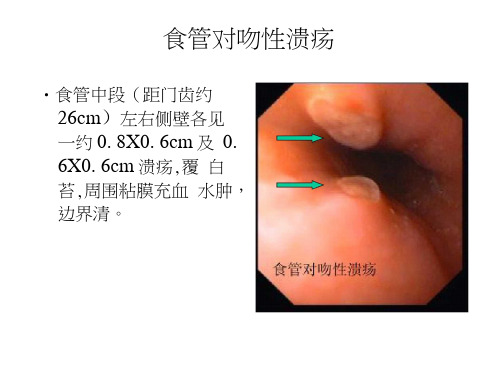 典型内镜图片