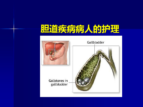 胆道疾病病人的护理-精品医学课件