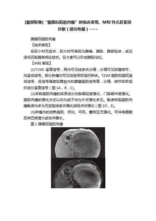 [腹部影像]“腹膜后脂肪肉瘤”的临床表现、MRI特点及鉴别诊断（建议收藏）~~~