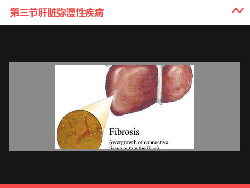 肝脏弥漫性疾病