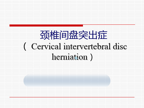 颈椎间盘突出症ppt课件