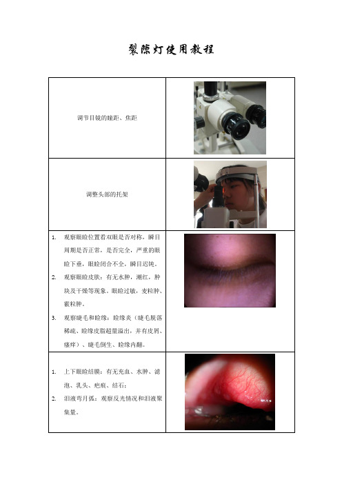 裂隙灯使用教程