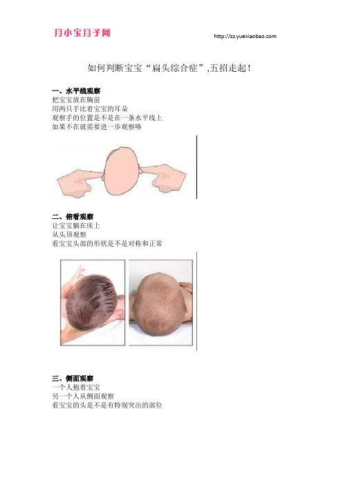 如何判断宝宝“扁头综合症”