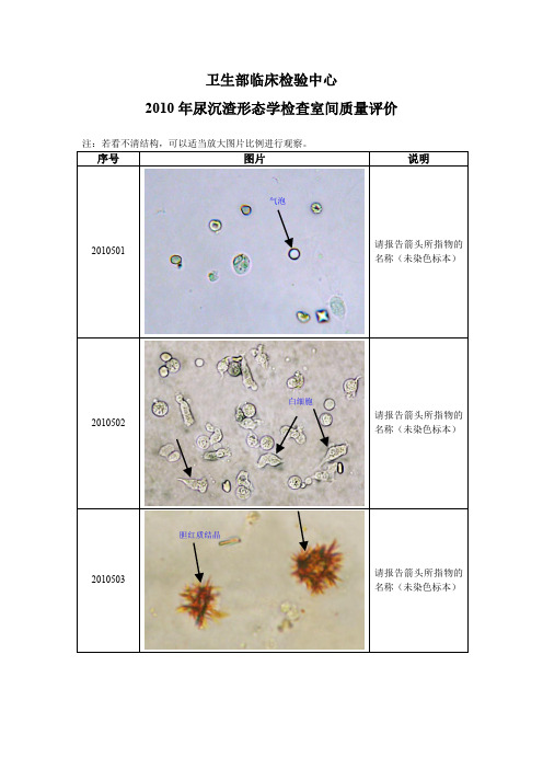 2010年尿液沉渣形态学检查室间质量评价图片