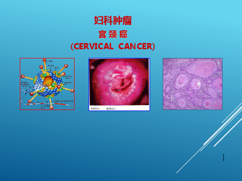 妇产科学-妇科肿瘤PPT课件
