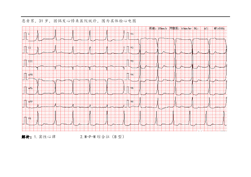 心电图诊断及解析2