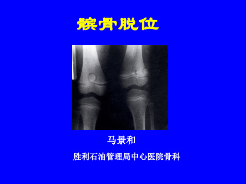 外科学多媒体课件 髌骨脱位