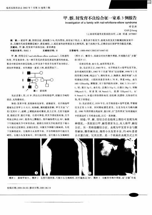 甲、髌、肘发育不良综合征一家系3例报告