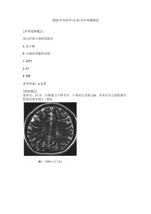 2019年内科学(正高)历年真题精选