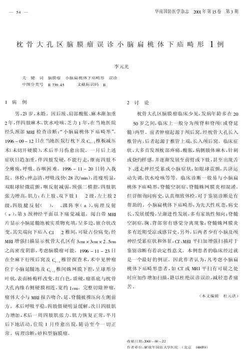 枕骨大孔区脑膜瘤误诊小脑扁桃体下疝畸形1例